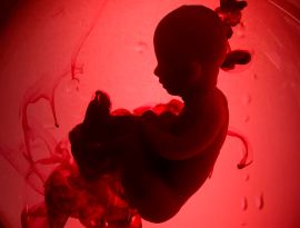 Вместо абортов. Почему в России стремительно выросло число женских стерилизаций
